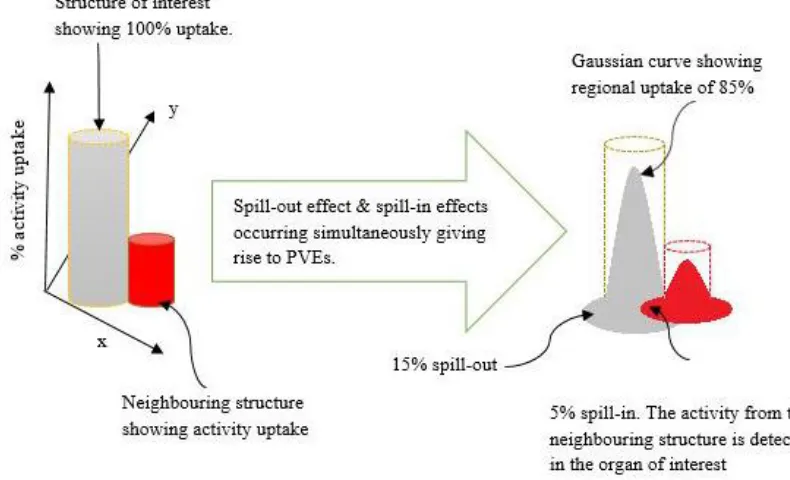 Fig. 2. Spill-out and spill-in effects occurring simultaneously in the presence of radioactive neighbouring organ