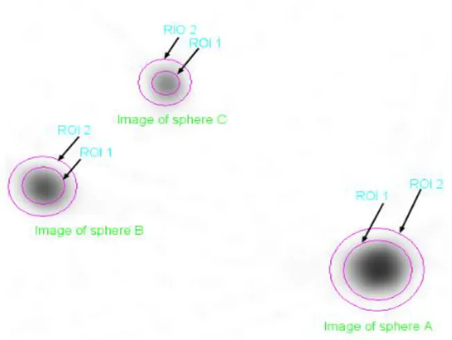 Fig. 5. ROI 1 and ROI 2 drawn on the 2D transaxial SPECT image slice reconstructed using FBP techniques