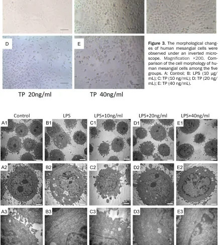 Figure 3. The morphological chang-es of human mesangial cells were 