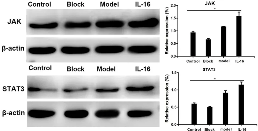 Figure 2. Inflammatory infiltration of rat prostate tissues in four groups (*400). (A) prostatitis group, (B) prostatitis + IL-6 group, (C) prostatitis + blocker group, (D) control group.
