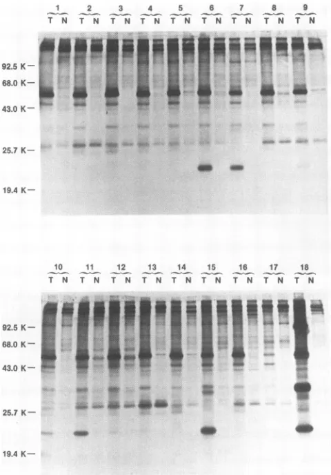 FIG. 2.resistant T antigens immunoprecipitated from subcl MT3 cells after pGVST transfection