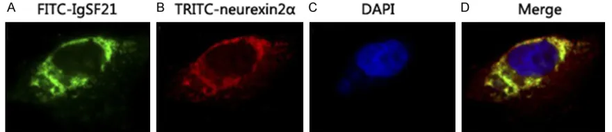 Figure 3. Spatial localization of IgSF21 and neurexin2α in cells. A: Spatial localization of IgSF21 in cell; B: Spatial lo-calization of neurexin2α in cell; C: The nucleus was stained with DAPI; D: Image A and image B were merged (×600)