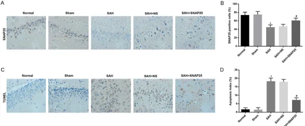 Figure 3. SNAP25 injection attenuated the reduction of SNAP25 and the increase of neuronal apoptosis in brain tissues of rats after SAH