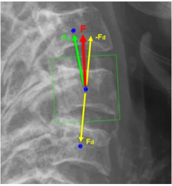 Fig. 5.3 Vertebral patch/ROI extraction.