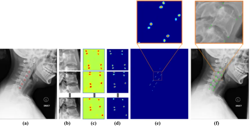 Fig. 5.14 Post-processing (a) input image with manually clicked vertebral centers (b) extractedimage patches to be sent forward through the network (c) patch-level prediction results fromthe network (d) patch-level predictions after removing residual probabilities (e) image-levelprediction (f) localized corners.