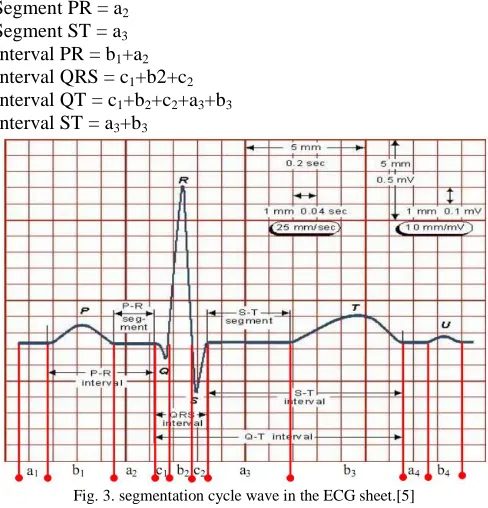 Fig. 3. segmentation cycle wave in the ECG sheet.[5]  