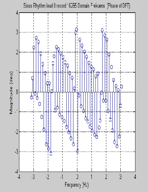 Fig. 4. Changes discrete signal from the time domain to the frequency domain 1 cycle leads II 