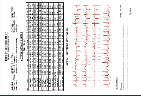 Fig. 6. Report measurement for record Srir-250-1 and record Masd-250-1 