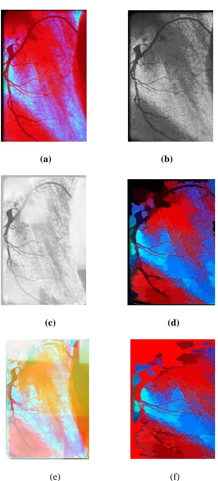 Fig.  4.  (a) Original input image. (b) 16 bit color scale image. (c) Thresholding, Segmented connected components labeling  (d) gray scale final  