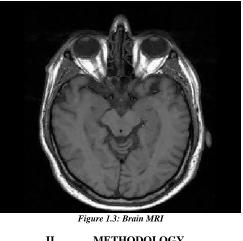 Figure 1.2: Schematic diagram of MRI machine  