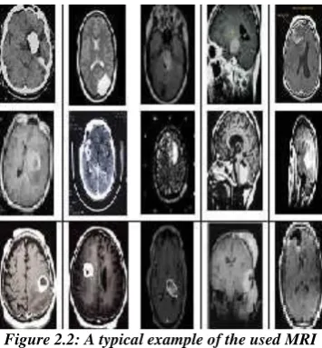 Figure 2.1: Proposed Methodology for Classification of MRI brain images   