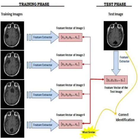 Figure 2.3 : Schematic diagram of a MR image recognizer. 