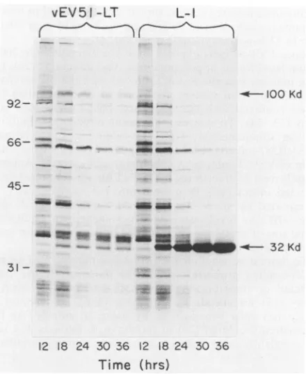 FIG. 2.andrecombinant35-mm-diameterwith(22).andbyweightthemercaptoethanol-1 Autoradiogram of proteins synthesized in recombinant wild-type virus-infected S