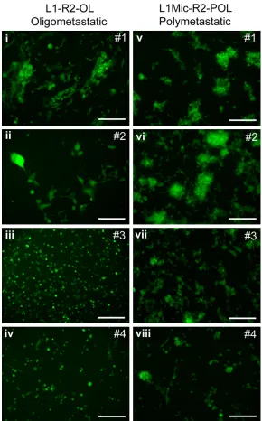 Figure 4. Generation of primary cell lines in the second round colonization assay. L1-R1-OL or L1Mic-R1-POL cells were injected via the tail vein