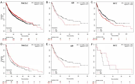 Figure 1. SQSTM1 protein expression in NSCLC tissues and matched normal tissues using IHC