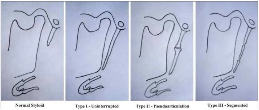 Figure:Langlais classification
