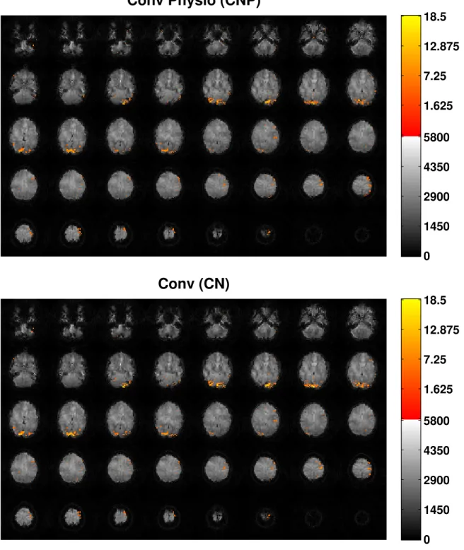 Figure 3.6: Activation maps over reconstructed images for run 1 of a conventional non- non-SMS scan of subject 3, with (top) and without (bottom) physiological noise correction.
