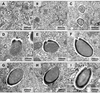 FIG 6 Morphogenesis of pandoravirus particles. Transmission electron microscopy images show stagesof pandoravirus particle formation