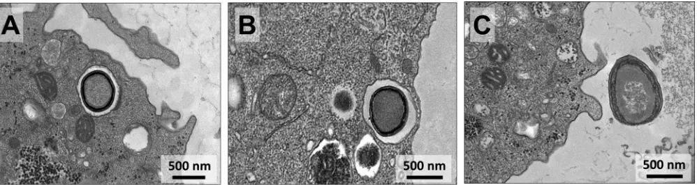FIG 8 Transmission electron microscopy images demonstrating sequential steps of pandoravirus particle exocytosis