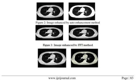 Figure 2: Image enhanced by auto enhancement method 