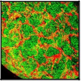 Figure 3. Cells were stained using 2 mMcalcein AM (green for live cells) and 4 mMEthD-1 (red for mostly silk fibroin and also dead cells) (Molecular Probes, Eugene, OR) for 30-45 min at room temperature and evaluated using a Bio-Rad MRC 1024 confocal micro