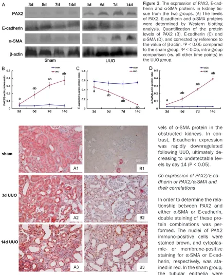 Figure 3. The expression of PAX2, E-cad-herin and α-SMA proteins in kidney tis-sue from the two groups