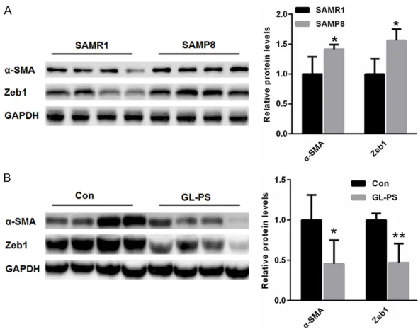 Figure 1. GL-PS treatment improved age-related EMT in the kidney of SAMP8 mice. A. Compared with that of SAMR1 mice, expression of α-SMA and Zeb1 was much higher in the kidneys of SAMP8 mice