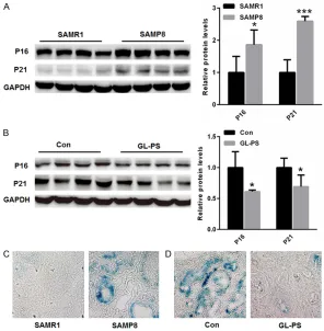 Figure 2. GL-PS treatment ameliorated renal cell senescence in aging kidneys. (A) Western blot analysis indicated that renal expression of P16 and P21 was increased in SAMP8 mice than that of SAMR1 mice