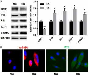 Figure 3. GL-PS treatment enhanced SIRT1 expression. A. Western blot analy-sis indicates that the expression of SIRT1 was decreased in the renal tissues of SAMP8 mice than that of SAMR1 mice