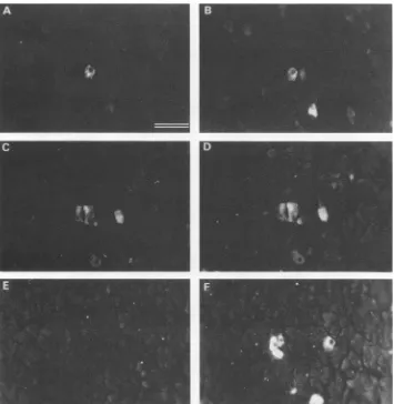 FIG. 1.fractionorescencephosphate-bufferedphosphate-bufferedaantigenorderpreparationimmunofluorescence 10-week-old Serum antibody reactivity for viral-antigen-positive pancreas acinar cells
