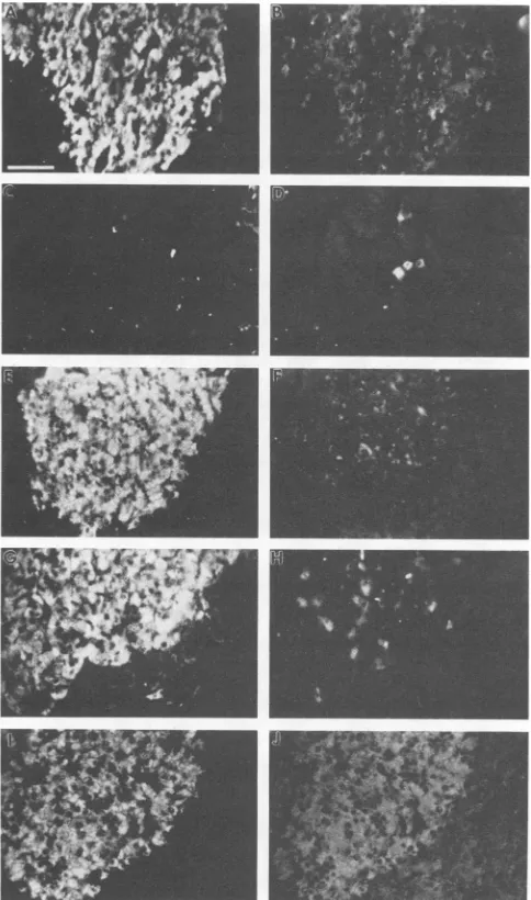 FIG.4.phate-bufferedbeenanti-surface(infectiontoantiglucagonbloodprovidepanelspancreaspancreascongenitallysameshown) provide Serum antibody reactivity for pancreas cells