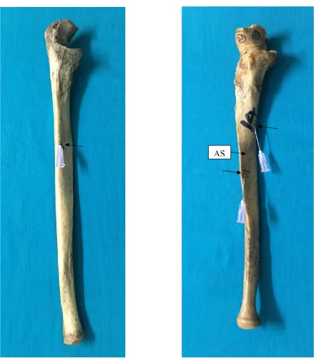 Fig. 9 – Ulnae showing single and double nutrient foramina. The bone with double foramina has two secondary foramina in the anterior surface, one in the upper third and the other in the middle third of the bone