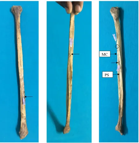 Fig. 16 – Fibulae showing single dominant foramen, single secondary foramen and double foramina in the first, second and third bones respectively