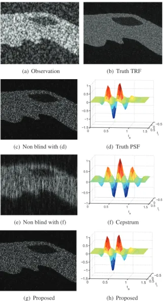 Table 1. Blind deconvolution performance of simulated US images.
