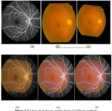 Figure 4 The first set of images and the fusion of different methods 