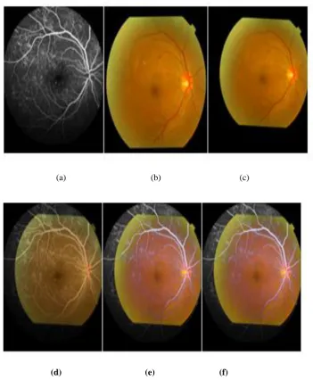 Figure 5  The second set of images and the fusion of different methods 