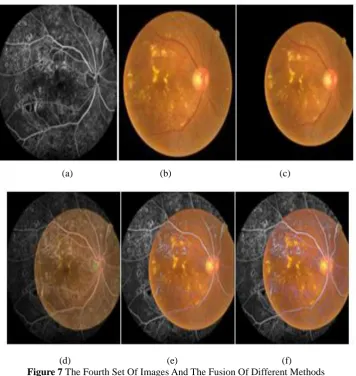 Figure 6 : The third set of images and the fusion of different methods 