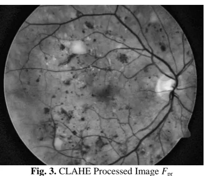 Fig. 3. CLAHE Processed Image Fpr  