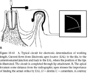 FIG 2: WORKING PRINCIPLE OF EAL 
