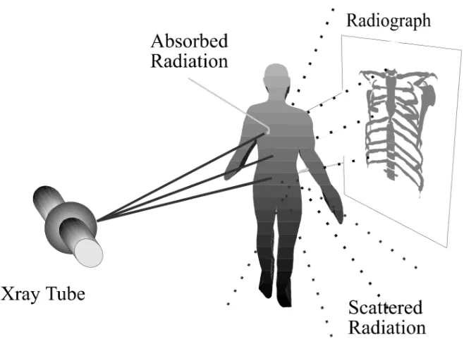 Figure 1.1: A typical X-Ray radiographic geometry [1]