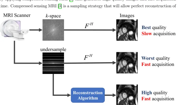 Figure 2: Overview of the CS-MRI problem.
