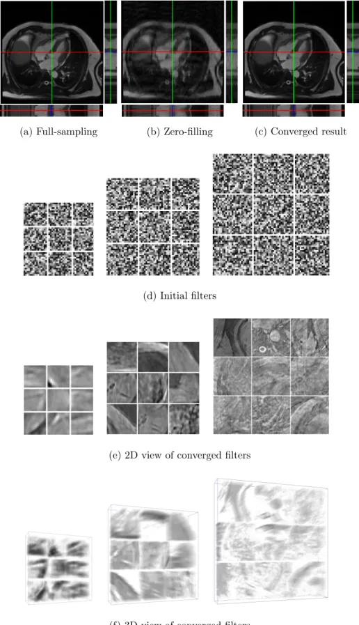 Figure 5: Overview multi-scale 3D CSC for CS-MRI reconstruction.