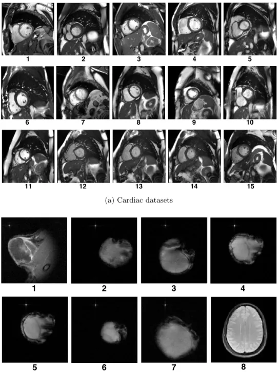 Figure 7: MRI datasets and Cartesian undersampling masks used in our experiments