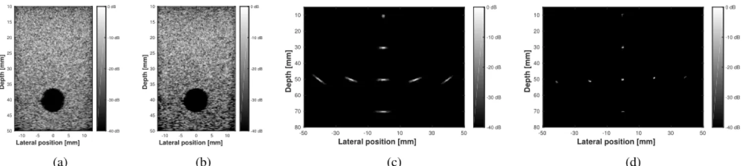 Fig. 3: B-mode images of the anechoic-inclusion phantom reconstructed with (a) DAS for 11 PW insonifications and (b) the proposed approach for 1 PW insonification, and of the point-reflector phantom reconstructed with (c) DAS for 11 DW insonifications and 