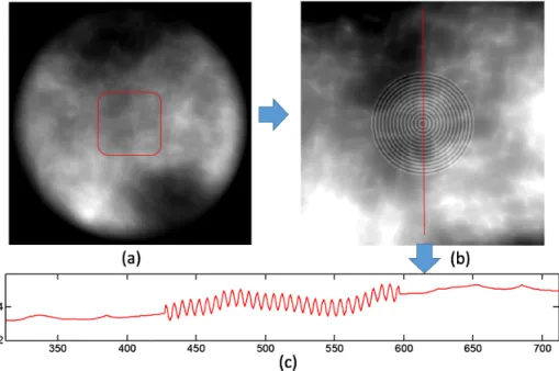 Figure 3.3: (a) The complete phantom. (b) A zoomed-in region of the phantom with adjusted gray-value window