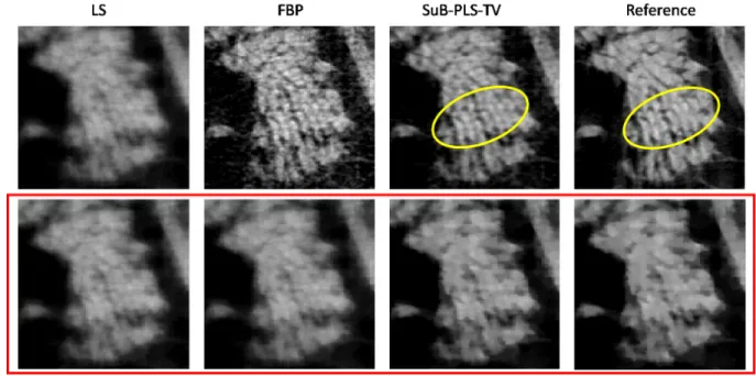 Figure 3.9: The comparison of the reconstructed ROI  by use of FBP, PLS-TV and SuB- 2 PLS-TV methods.