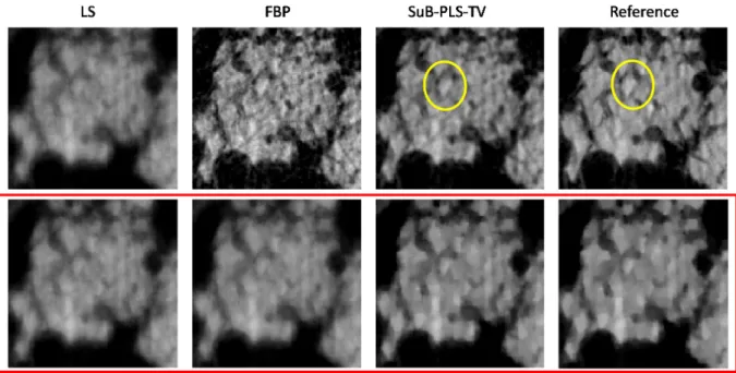 Figure 3.10: The comparison of the reconstructed ROI  by use of FBP, PLS-TV and 3 SuB-PLS-TV methods.