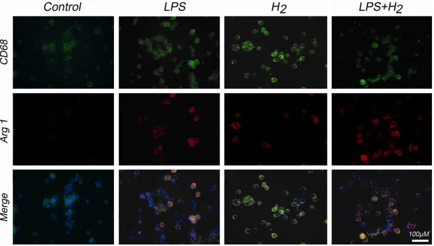 Figure 3. Treatment with 2% hydrogen showed increased M2 macrophages in ALI mice lung tissues