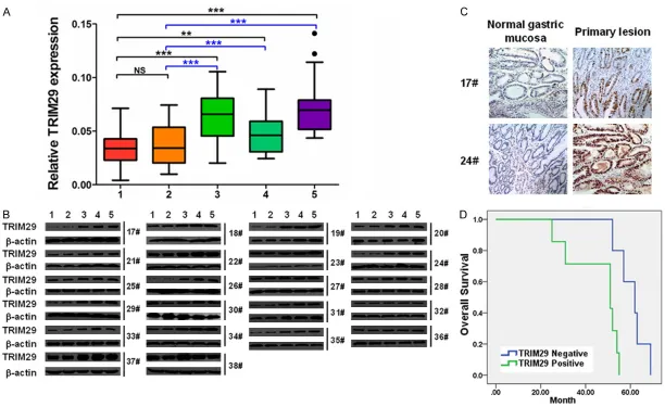 Figure 1. The expression of TRIM29 is increased in GC samples. A. The mRNA expression of TRIM29 was increased in primary lesions, positive lymph nodes and metastasis lesions groups of GC samples by quantitative real-time PCR assay