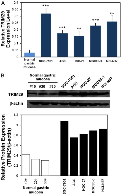 Figure 2. The expression of TRIM29 protein is highly expressed in GC cell lines. A. The mRNA expression of TRIM29 was increased in five GC cell lines com-pared with normal gastric mucosa by quantitative real-time PCR assay